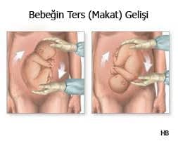 Makat Doğum Manevraları