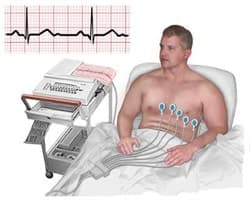 EKG Nedir?