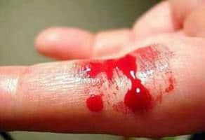 Kanama Bozukluğu Nedenleri?