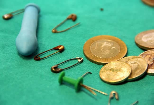 Yabancı Cisim Yutulması