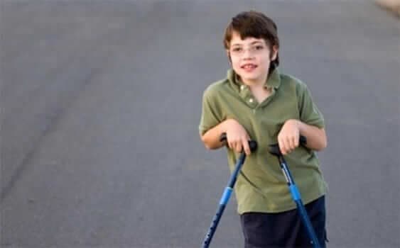 Serebral Palsi Belirtileri