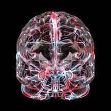 Serebrovasküler Olay