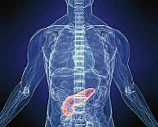 Pankreatit  (Akut Başlangıç)