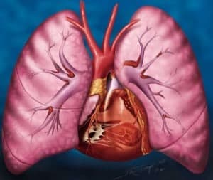 Pulmoner  Tromboemboli